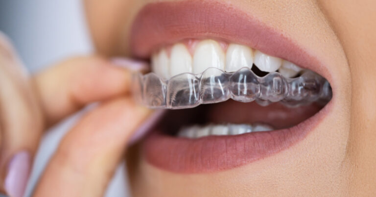 invisalign em canoas